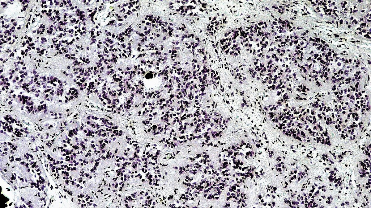 Connective-tissue histology showing collagen fibres embedded in the ground substance of the extracellular matrix; a Bodencore feature by Panacea Bio Chem and Bogdan Dicoias